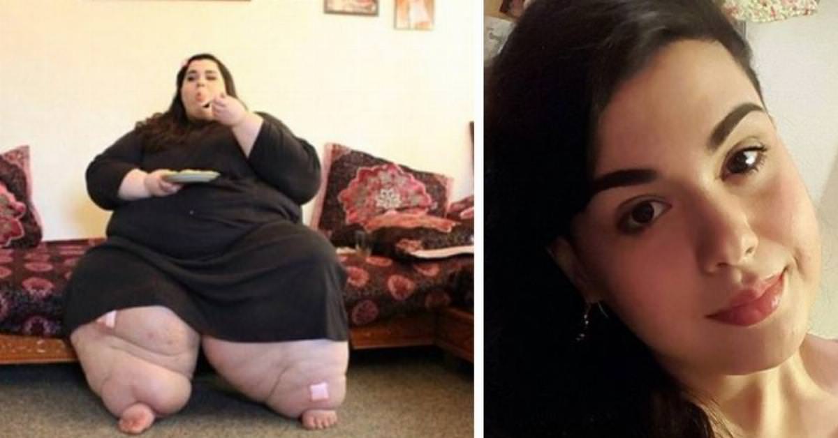ViraLife A 24 year old Has Weighted 600 Lbs Now Watch Her Amazing 