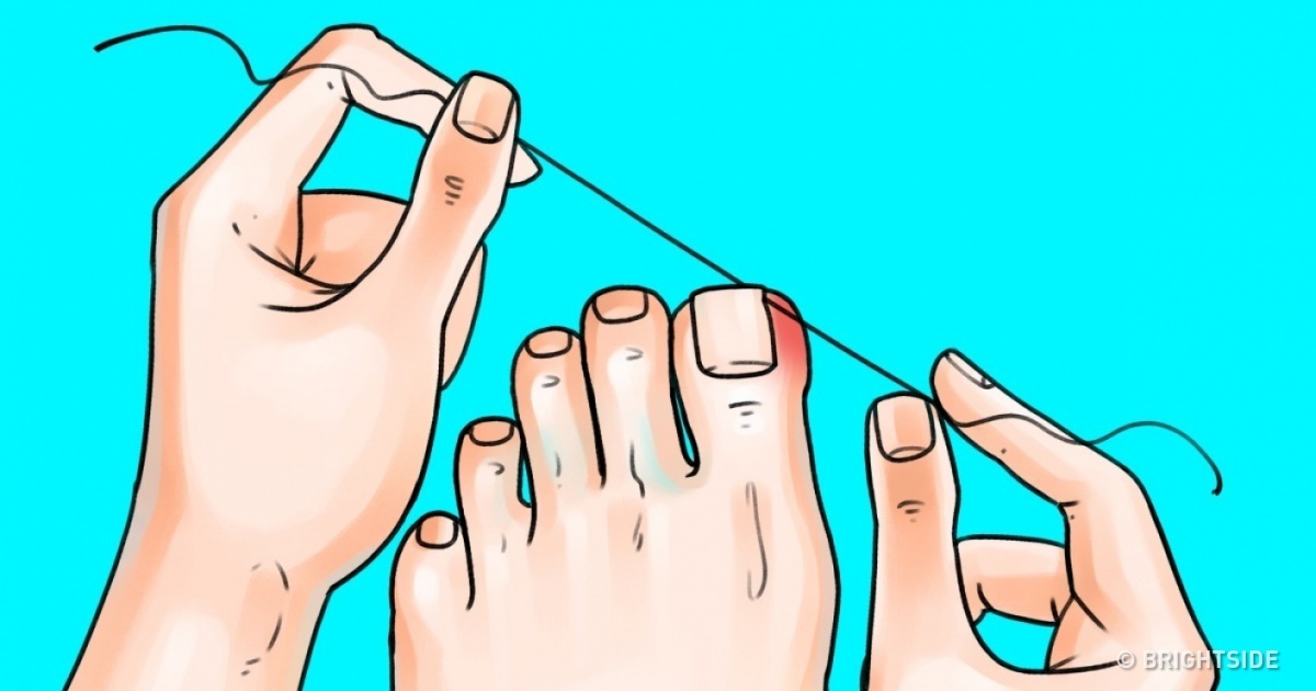 6 great tips to make your feet and nails look amazing
