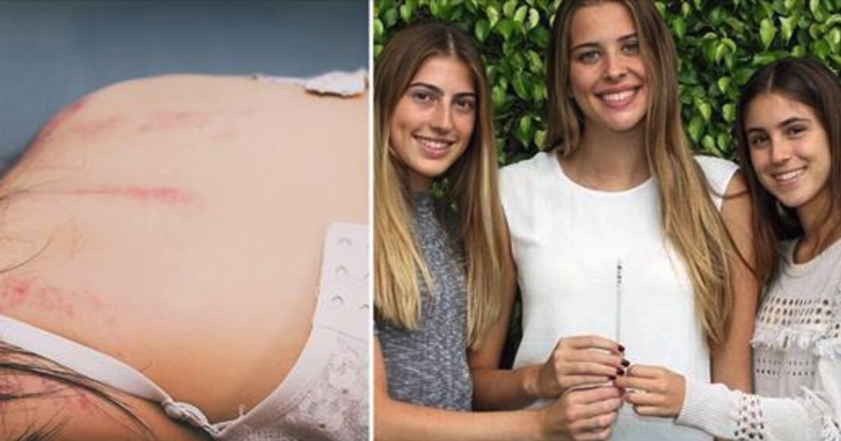 3 girls wanted to prevent rape - now their ingenious invention can save lives