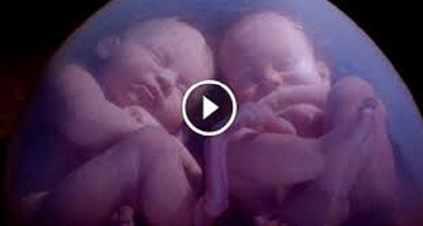 A routine MRI scan revealed twins doing an amazing thing inside their mother's womb
