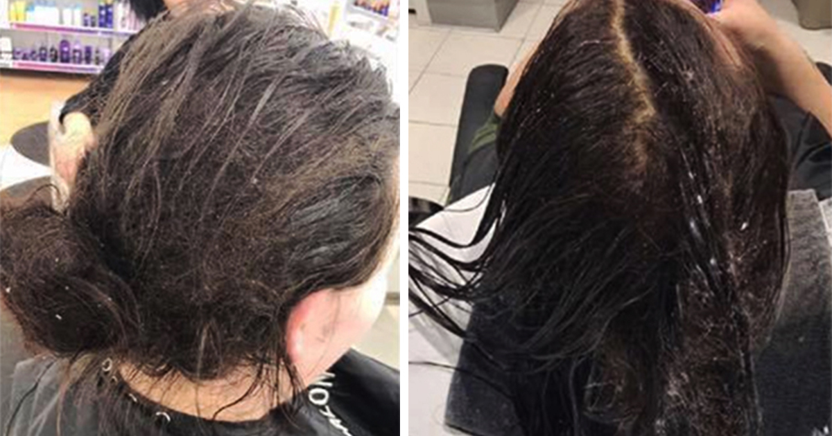 A woman hasn't washed her hair in six months - now watch the amazing result 8 hours later