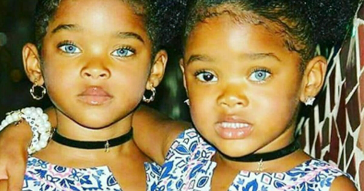 The 'Blue Twins' made headlines all over the world thanks to their amazing eyes - and this is how they look today