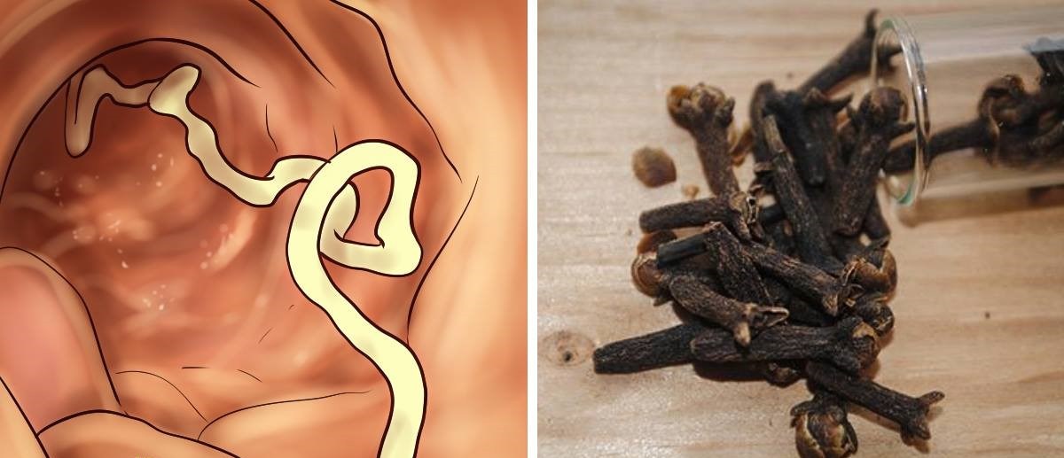 9 warning signs that your body is full of parasites - and what to do to eliminate them