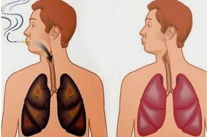 This recipe will easily clean your lungs, even if you have been smoking for 5 years!