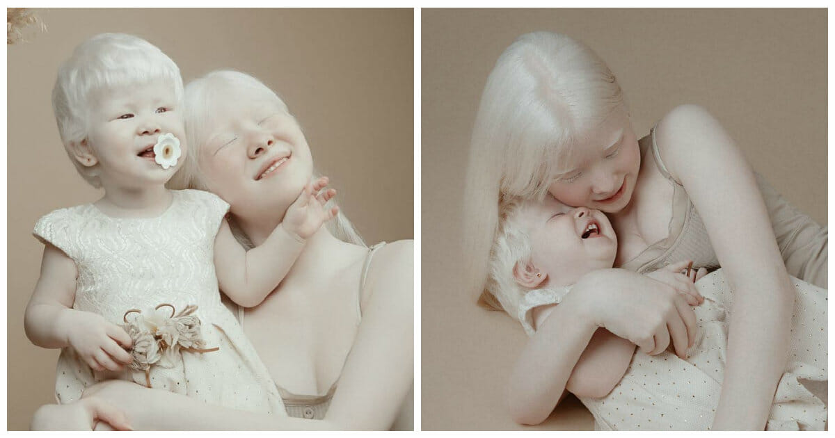 Albino sisters born 12 years apart became a modeling sensation
