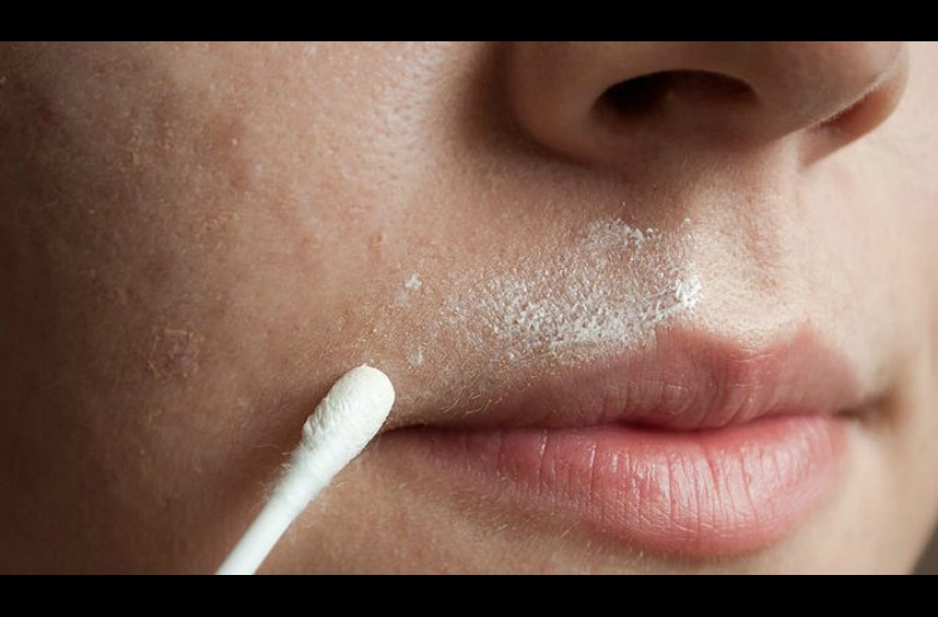Get rid of annoying facial hair forever with this natural solution