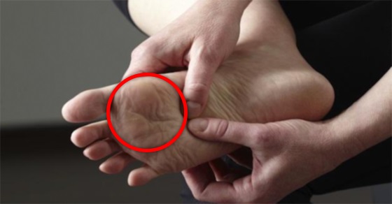 If you noticed this happening to your feet, you may have a serious health problem