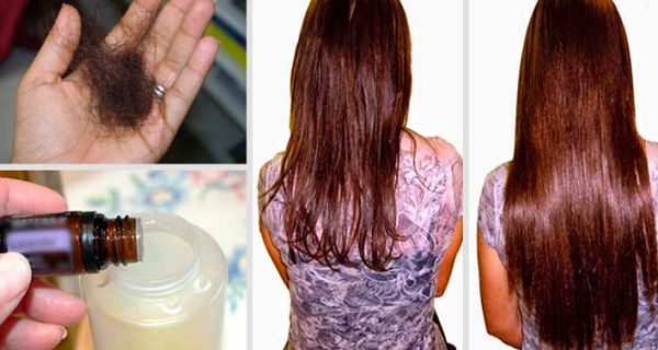 Add these 2 ingredients to your shampoo and say goodbye to hairloss forever!