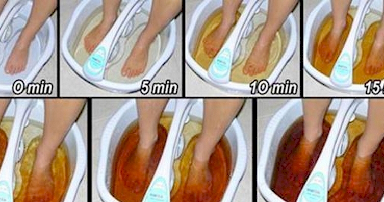 This is how you can detoxify your body through your feet
