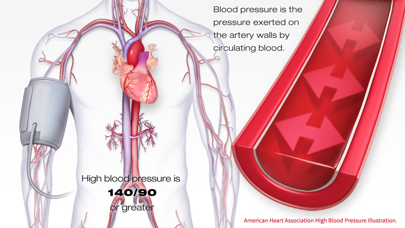 10 ways to reduce hypertension naturally and without medications