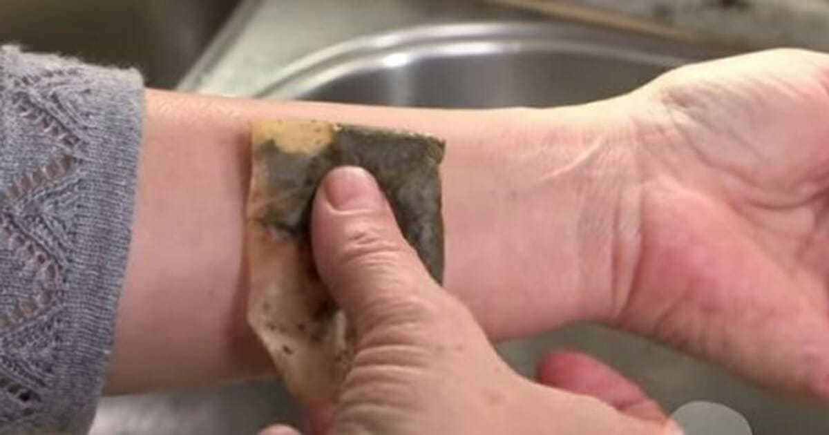 A woman puts a tea bag on her wrist and a few minutes later? The result is simply amazing!