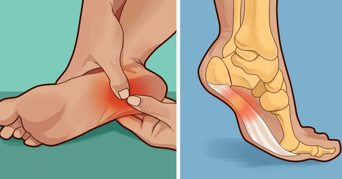 Does your heel hurt in the morning or whenever you stand? This is what you need to know