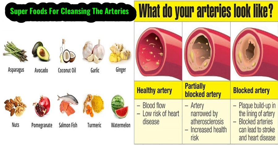 clean arteries naturally