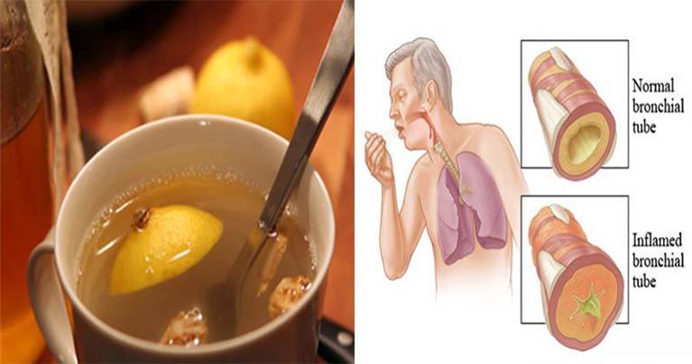 This 3-ingredients medicine will remove the phlegm from the lungs and strengthen your immune system!
