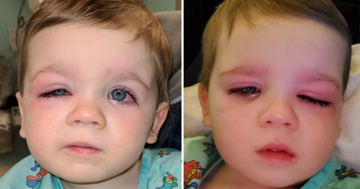 A mother warns all parents after her son almost lost his sight because of a bath toy