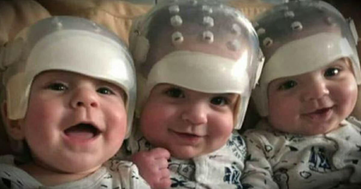 They are the rarest triplet in the world: see how they look after a historical surgery