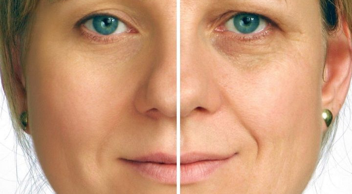 Remove wrinkles and look 5 years younger with the help of this natural face cream