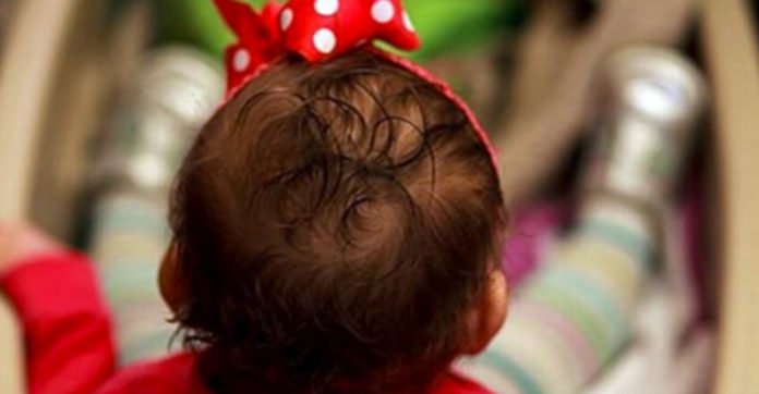 A 14-week-old baby died because of what her mother put on her head