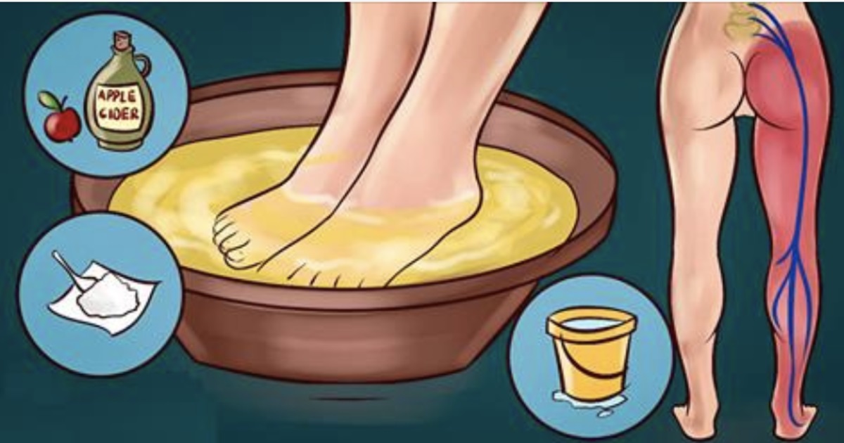 Try this trick and say goodbye to sciatic pain forever!