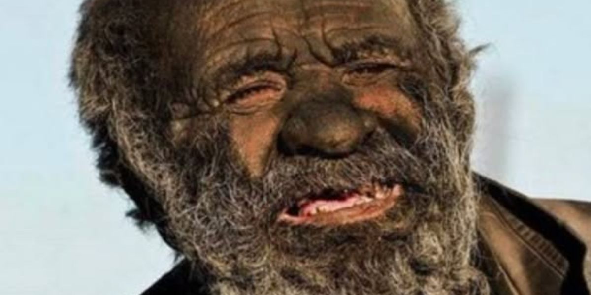 He didn't shower for more than 60 years - his reason stunned everyone, and what happened after his first bath made the story even more chilling